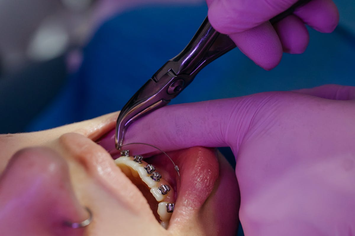 Close-up Photo of Dentist Examining Patient's Teeth