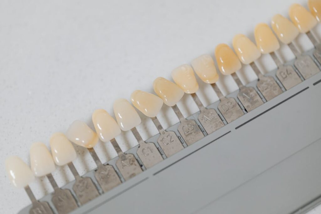 dental Veneers