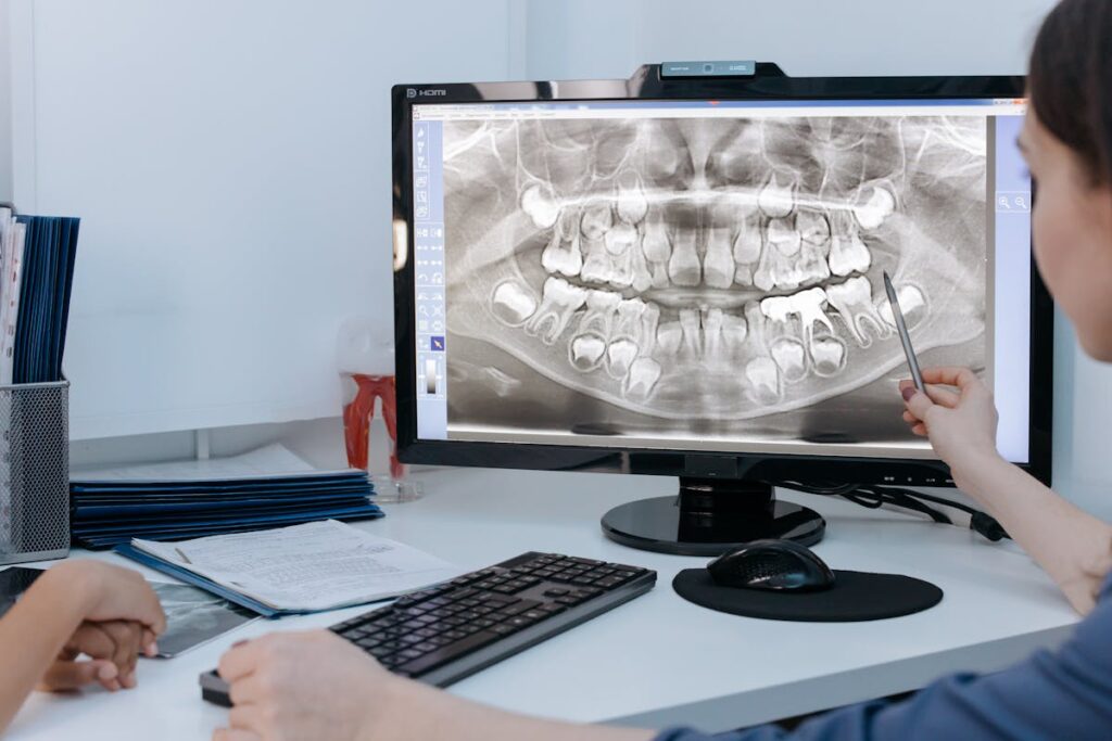 Close-Up Shot of a Person Pointing at the Xray Image