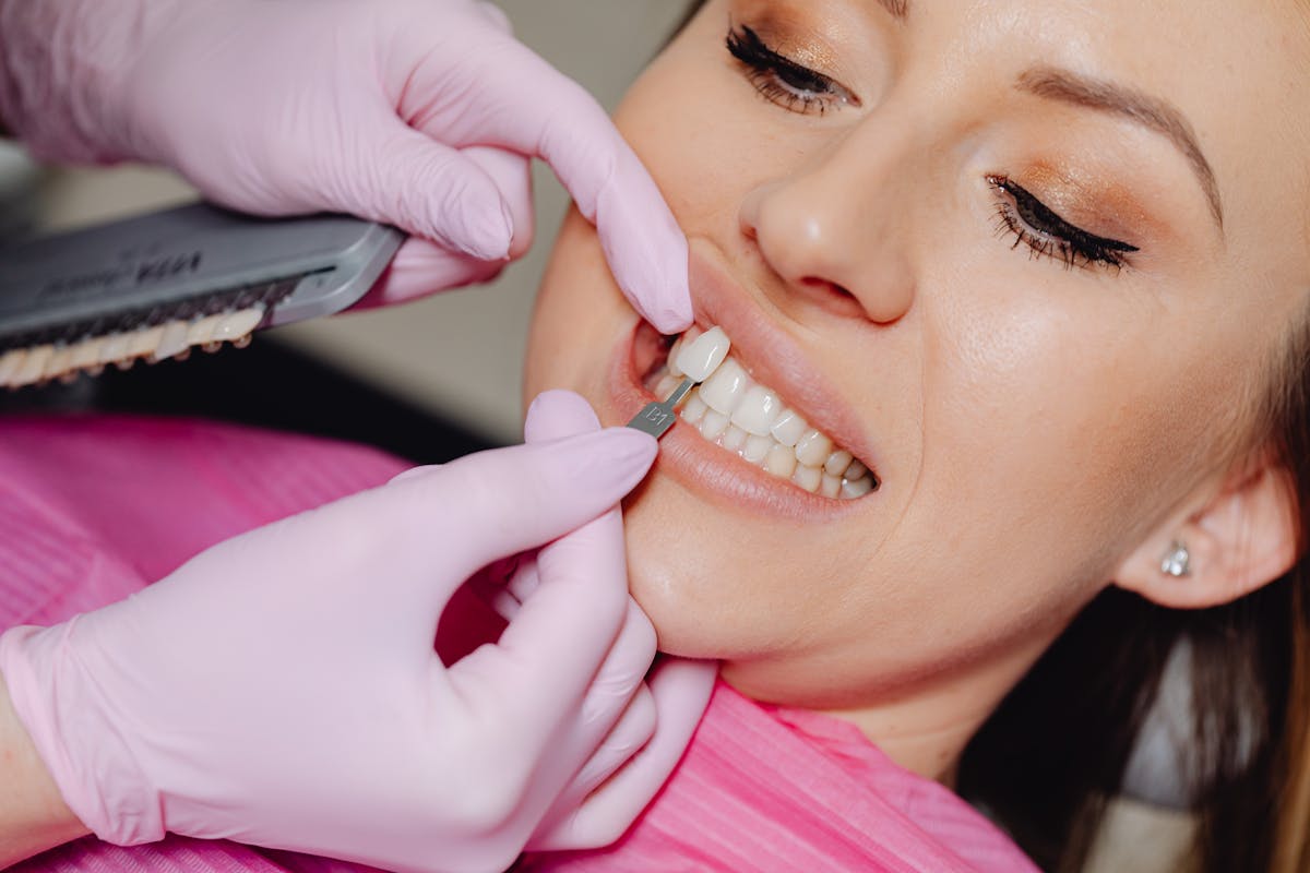 Dentist Applying a Veneer Tooth on a Patient