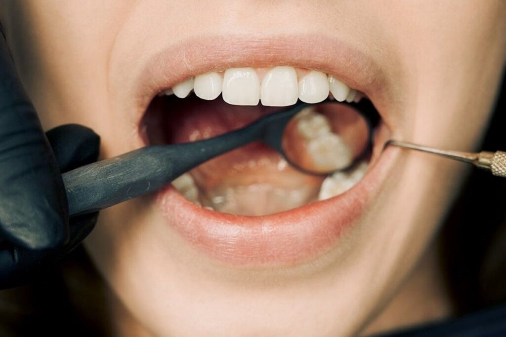 Dentist Checking Teeth of a Person