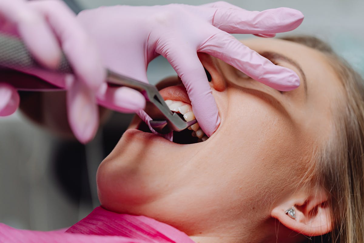 Photo of a Person with Pink Gloves Checking a Woman's Teeth